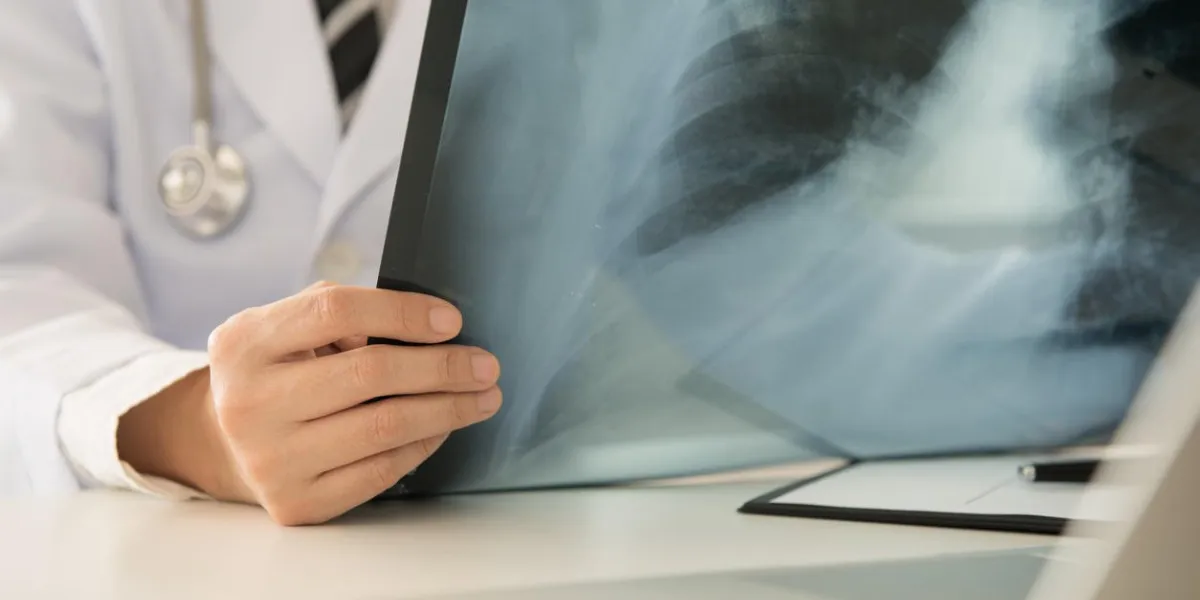 radiologist doctor examining at lungs radiograph x-ray film of patient in roentgen room