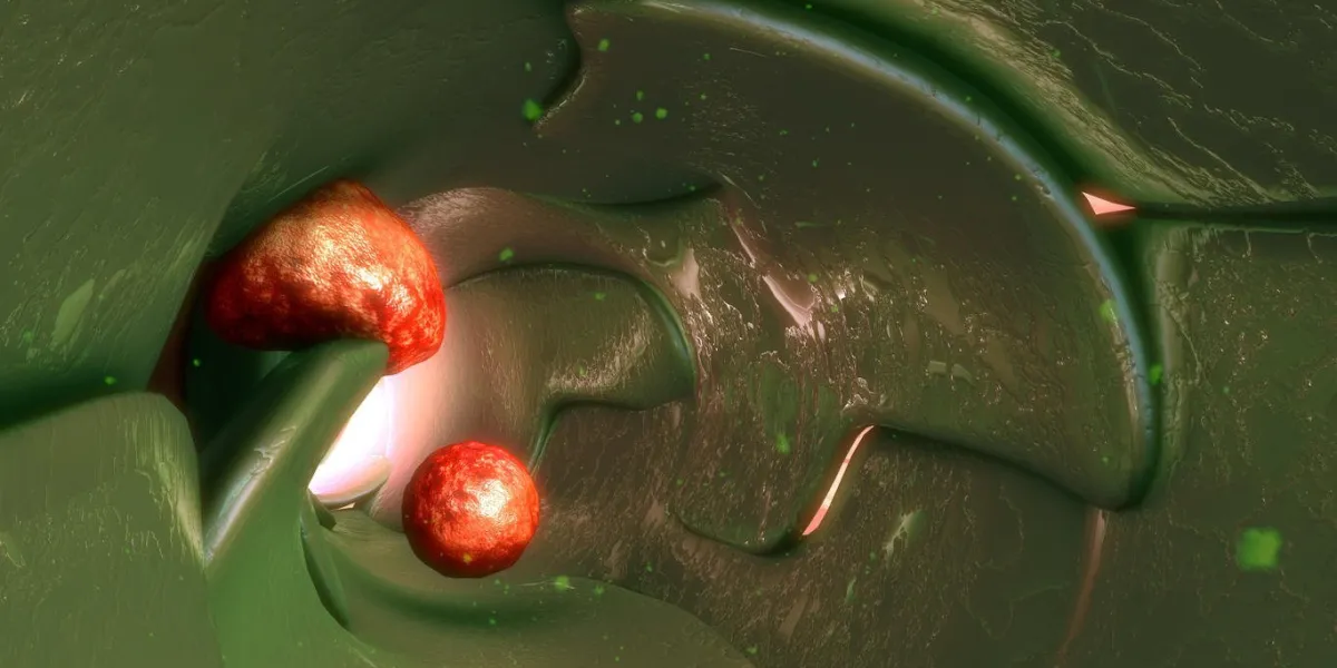 la douleur ou l'enflure au niveau des ganglions lymphatiques est un symptôme courant du cancer qui débute dans le système lymphatique, comme le lymphome non hodgkinien et le lymphome hodgkinien