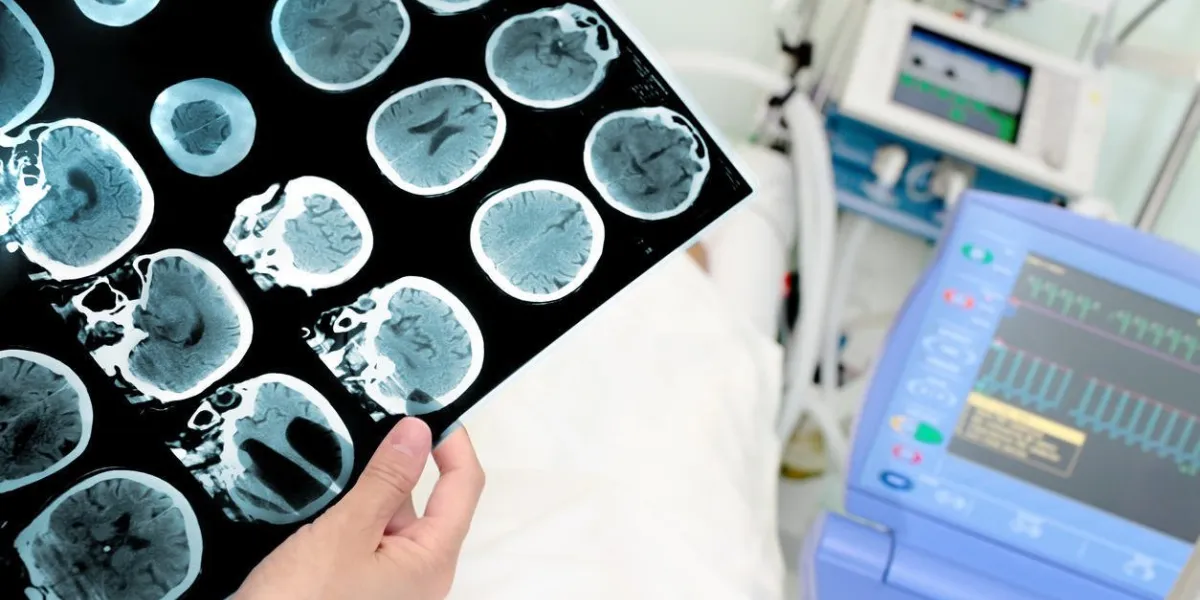 ct scanner de la tête à l'hôpital