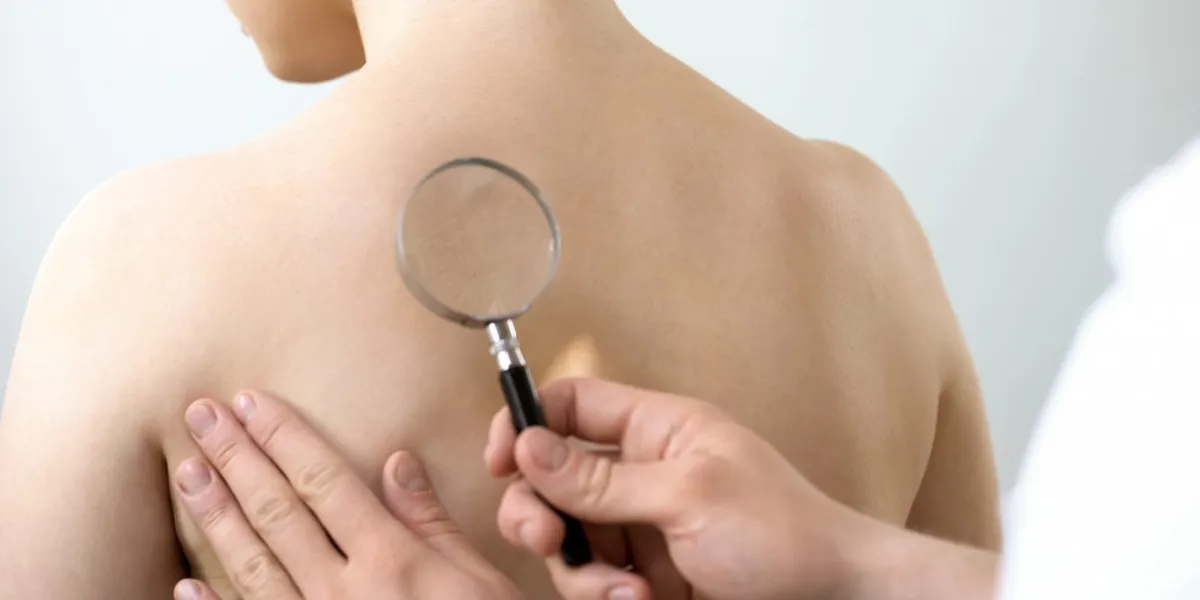 dermatologist examining ladys skin through magnifying glass, cancer prevention