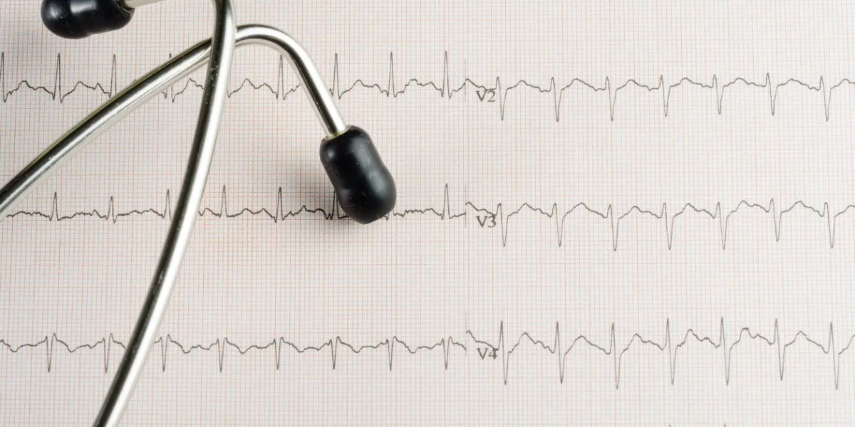 examen médical, électrocardiogramme, médecine cardiaque et thérapie