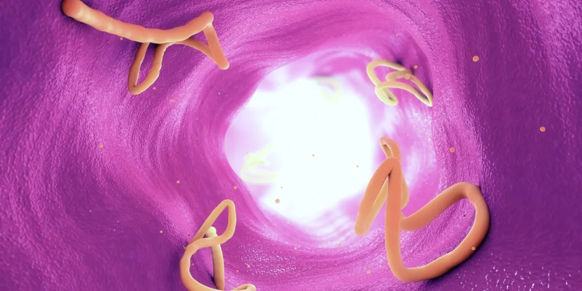 tapeworm infestation in a human intestine - 3d illustration