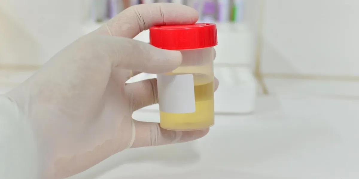 bilan médical de contrôle et bandelettes de test d'urine