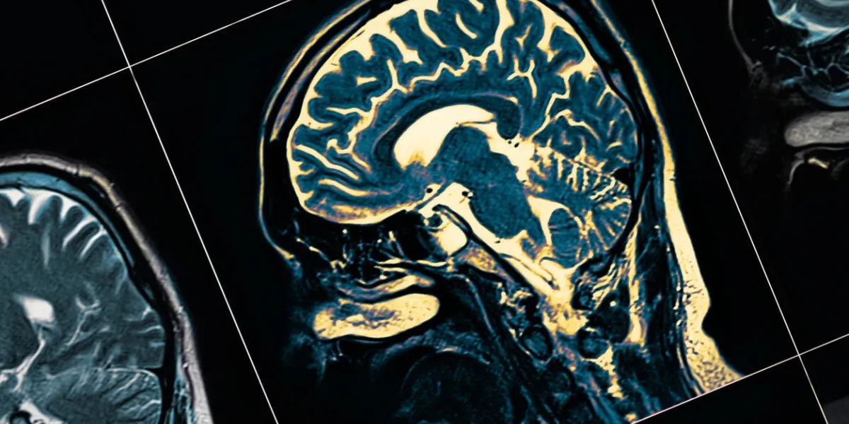 mri of the patient's head close-up one picture from the series