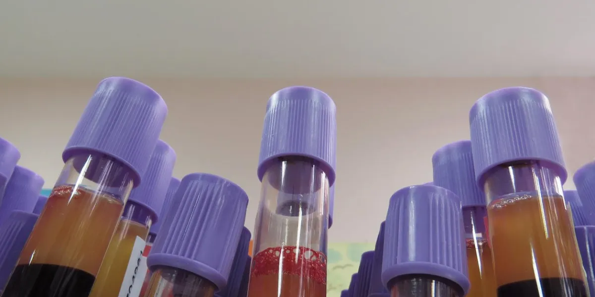 blood tubes for testing after blood donation, in a rack