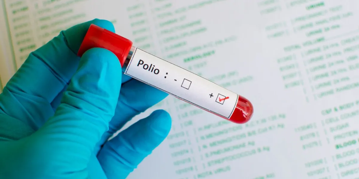 blood sample with polio virus positive