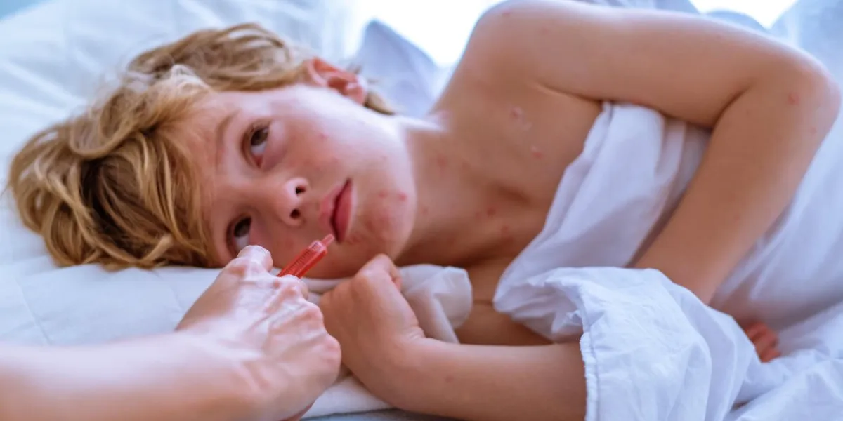 enfant avec la varicelle
