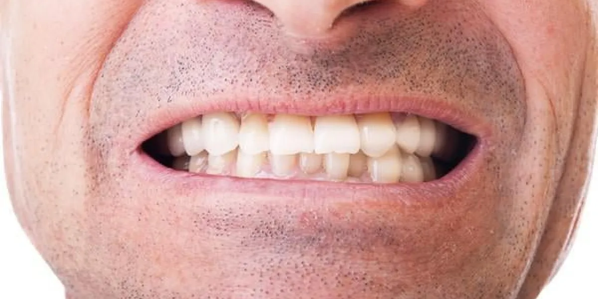 la bouche des hommes avec des dents