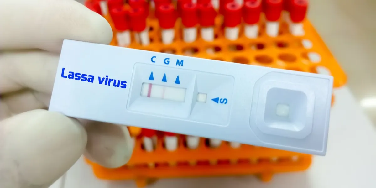 scientist hand hold rapid test cassette for lassa virus test, medical and health concept