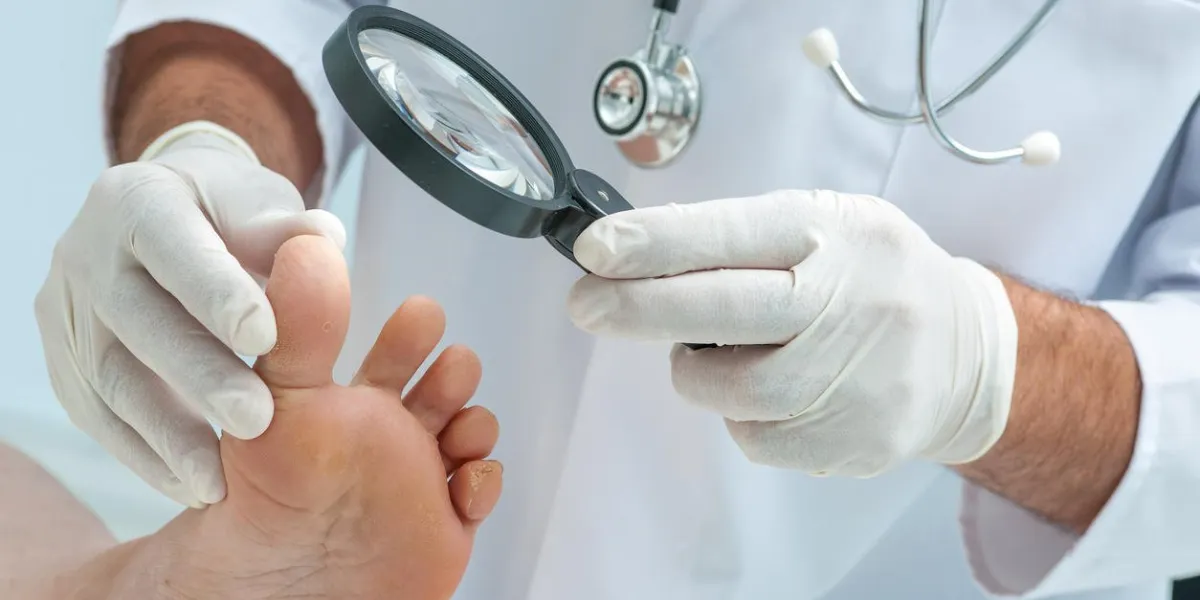 médecin dermatologue examine le pied sur la présence du pied de l'athlète