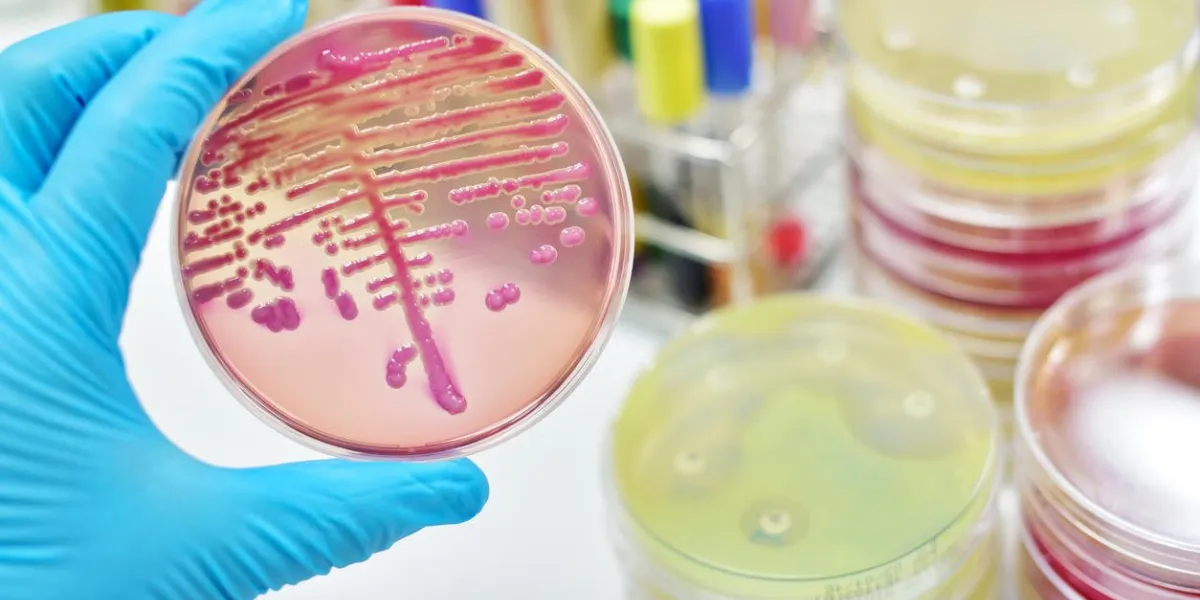 colony of bacteria in culture medium plate