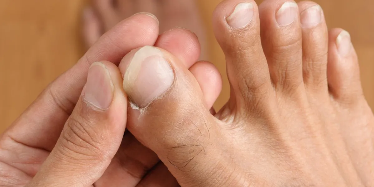 foot, toe and toenail of the man