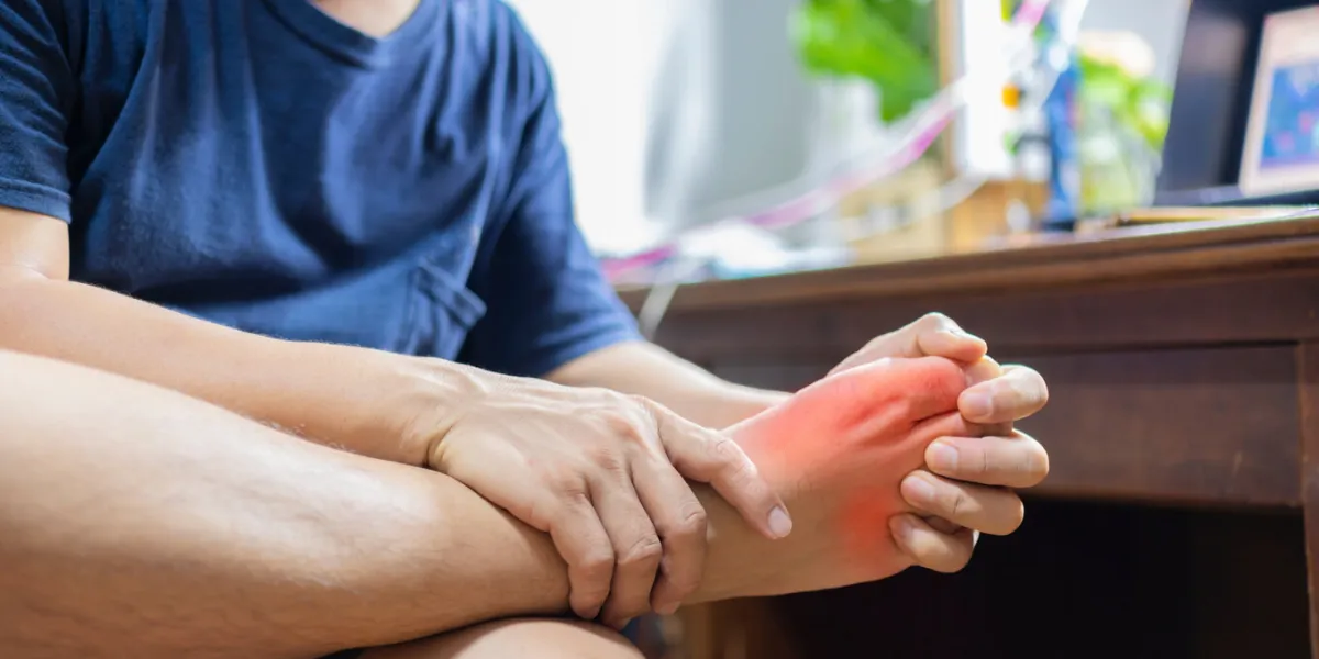 man with painful and inflamed gout on his foot around the big toe area