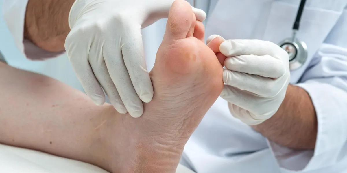 médecin dermatologue examine le pied sur la présence du pied de l'athlète