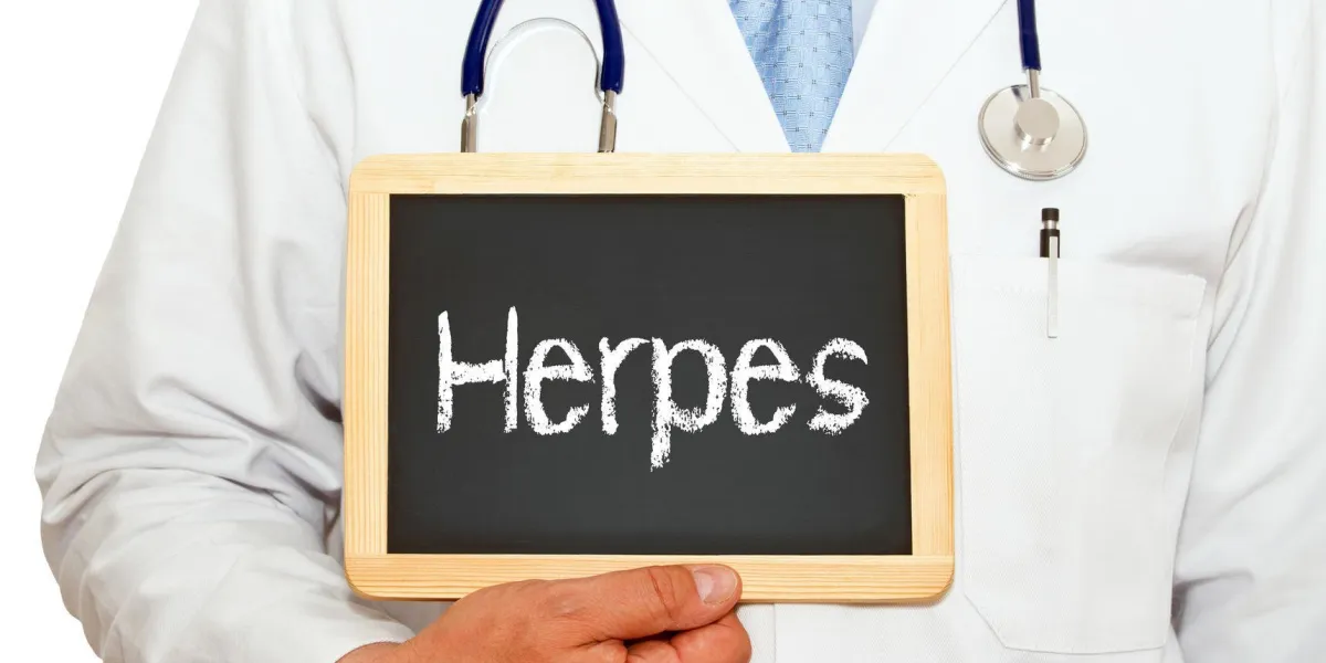 herpès