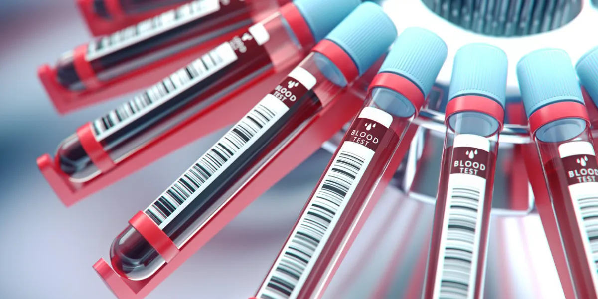 lab equipment centrifuging blood concept image of a blood test3d renderinglab equipment centrifuging blood concept image of a blood test3d rendering