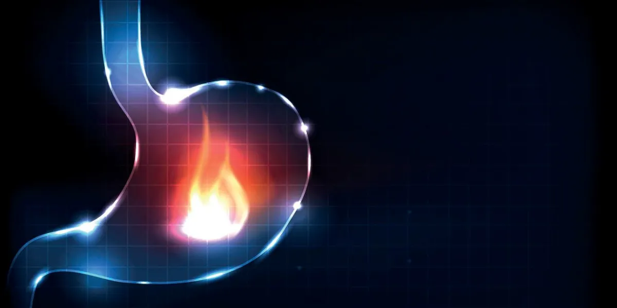 estomac humain brûlant le feu dans le concept de douleur estomac estomac