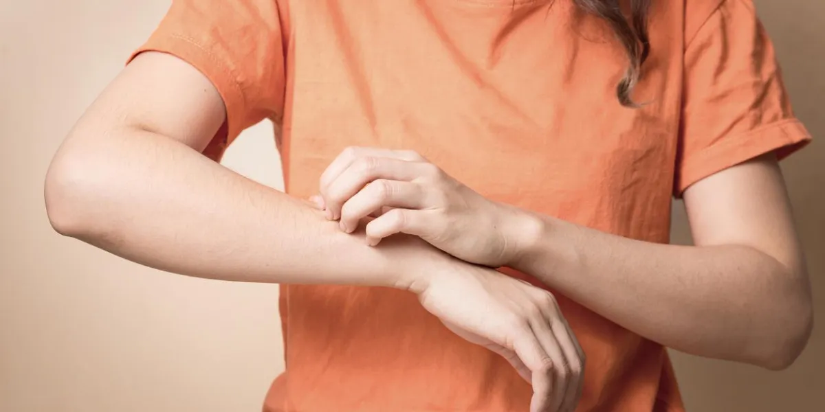 women scratch itchy arm with hand