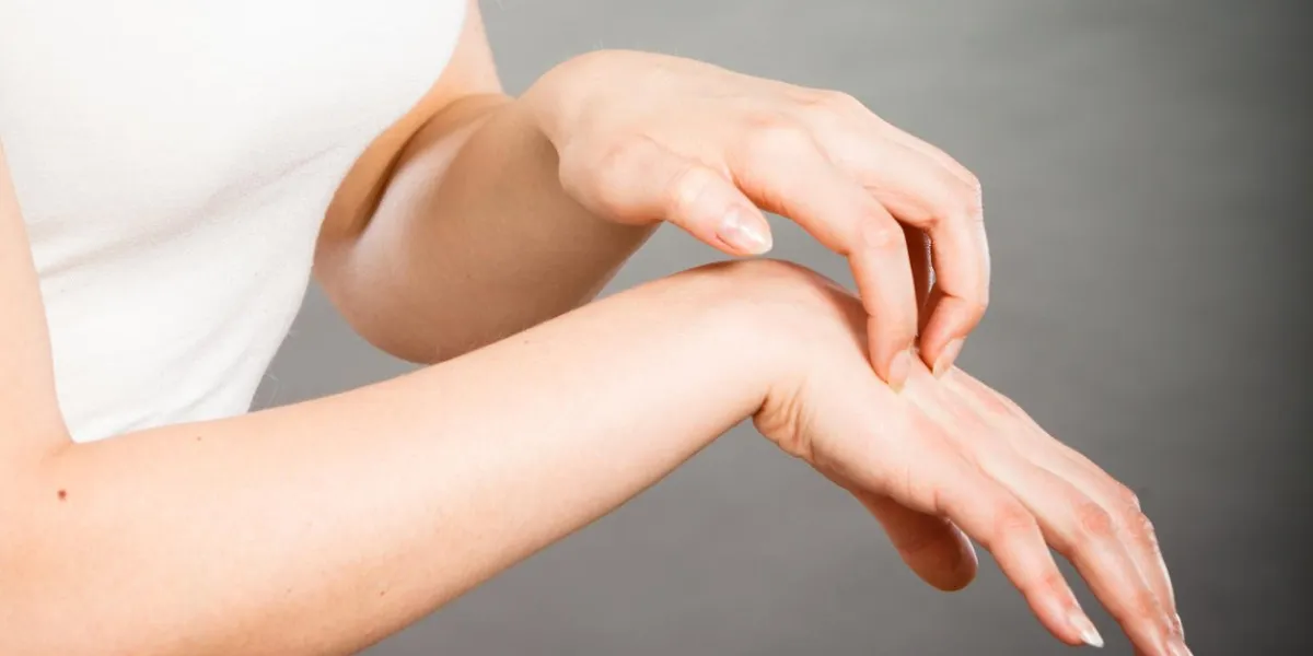 dermatologie, allergie et problème de santé jeune femme gratter sa paume démangeaison avec une éruption allergique