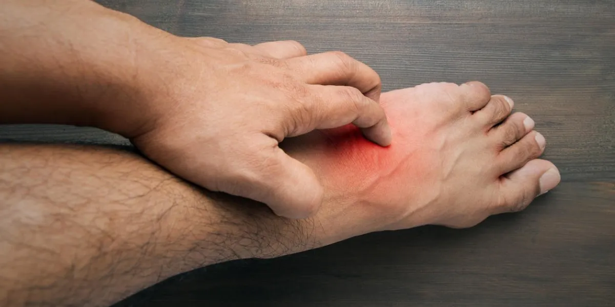 man scratch the itch with hand , itching, foot, concept with healthcare and medicine