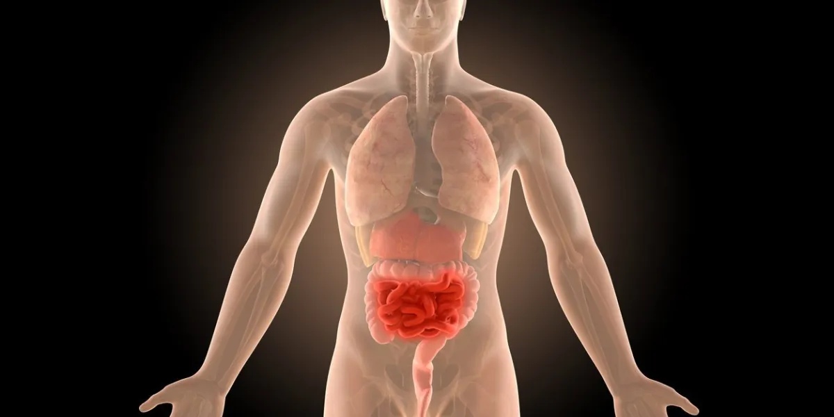 3d illustration human body crohn's intestines infection with clipping path