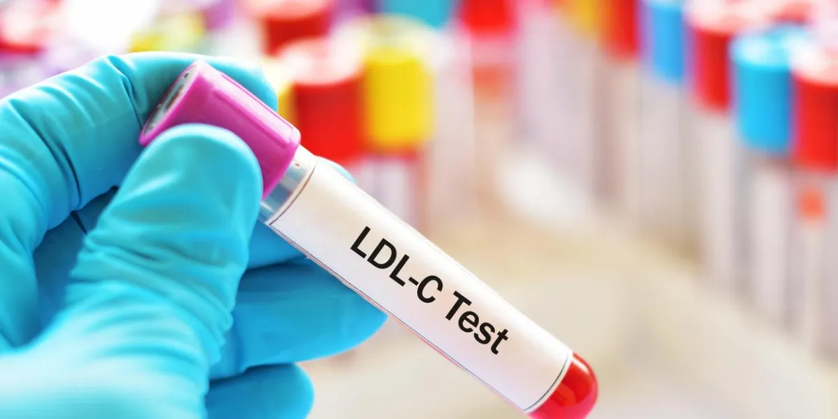 blood sample for ldl-cholesterol test