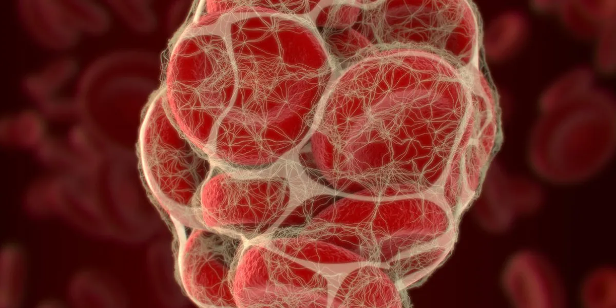 caillot de sang, coagulation 3d illustration caillot de sang, coagulation 3d illustration