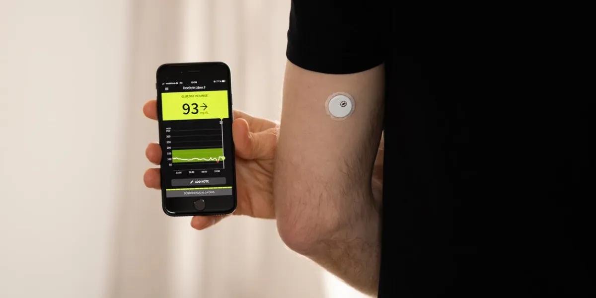 dresden, freestyle libre 3 sensor and app on the smartphone the cgm device is measuring the glucose in the tissue and sending data to the digital health application