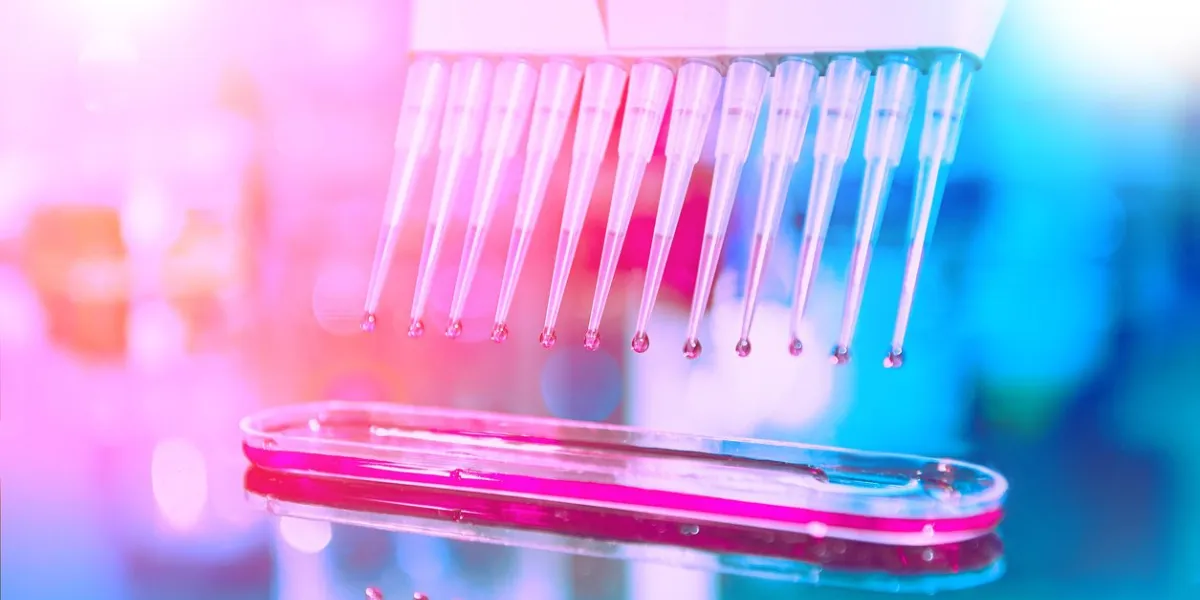 papid molecular assay, pcr analysis for express testing of novel novel 2019-ncov coronavirus infection, viral pneumonia outbreak from china multichannel pipette tips filled with reaction mixture