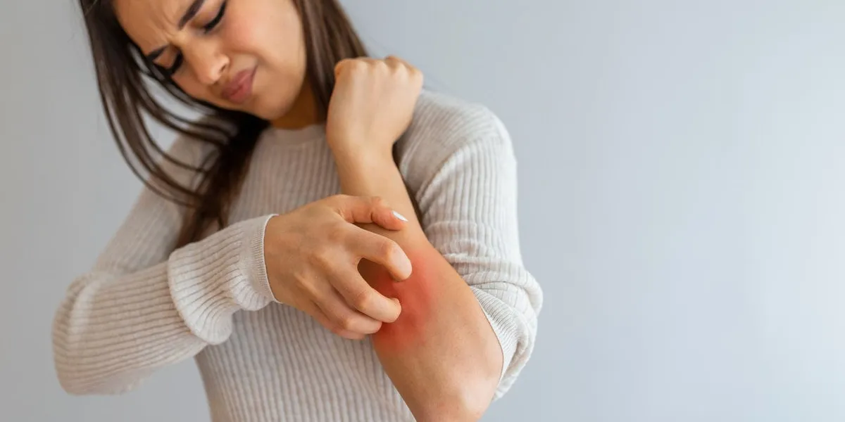 health problem, skin diseases young woman scratching her itchy arm with allergy rash woman scratching her arm woman scratching arm indoors, space for text allergy symptoms