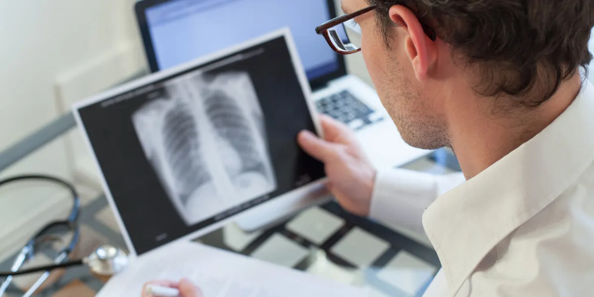 doctor looking at x-ray of lungs and writing diagnosis