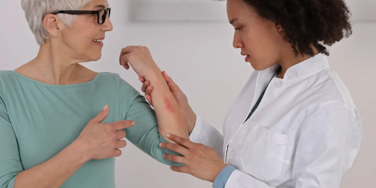 sensitive skin, food allergy symptoms, irritation doctor dermatolog and patient