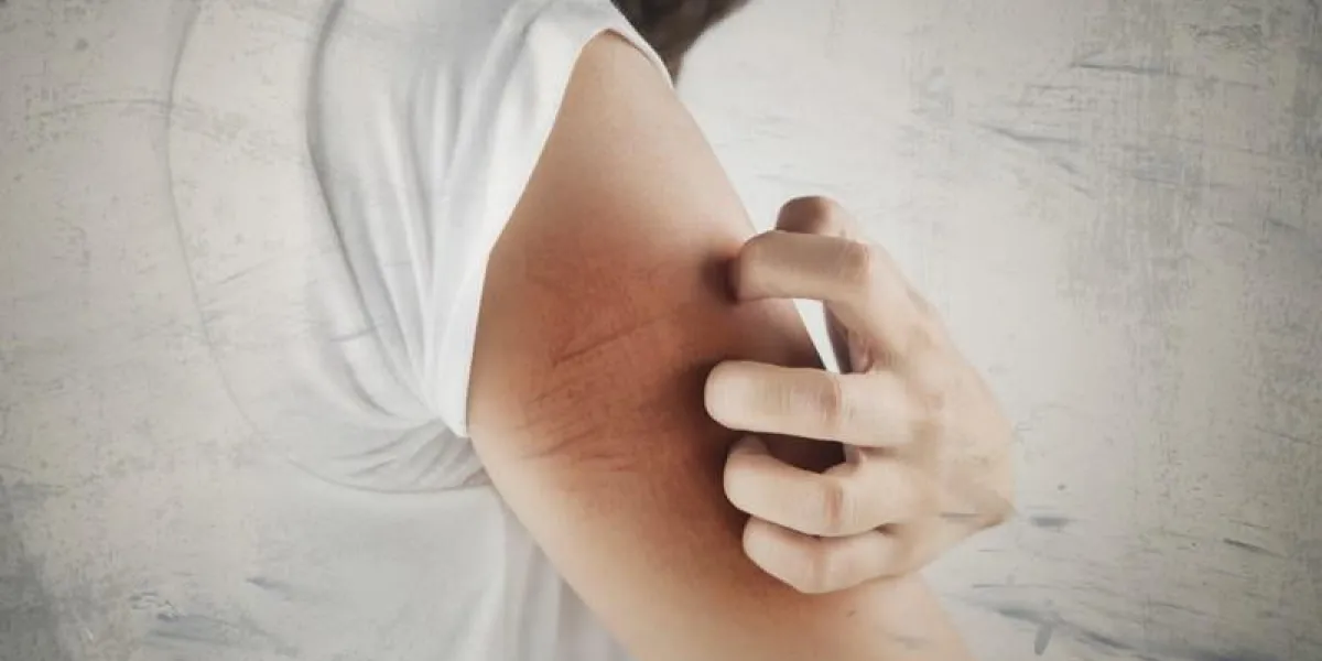 femme se gratter le bras