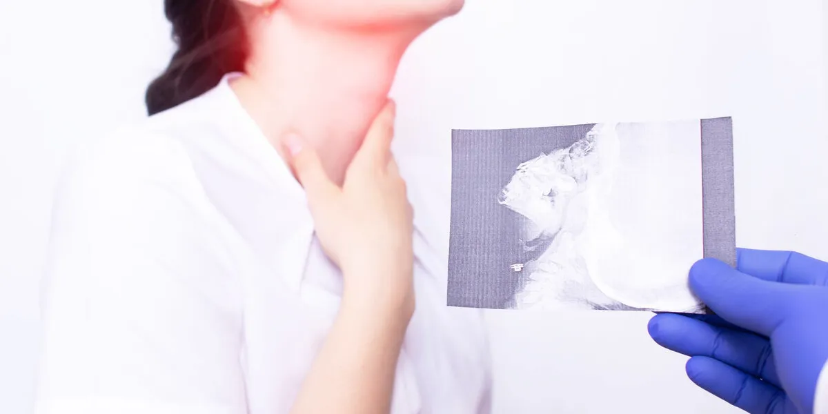 dr ent holds an x-ray picture on the background of a young girl who has inflammation and sore throat due to adenoids, inflammation of the tonsils, medical