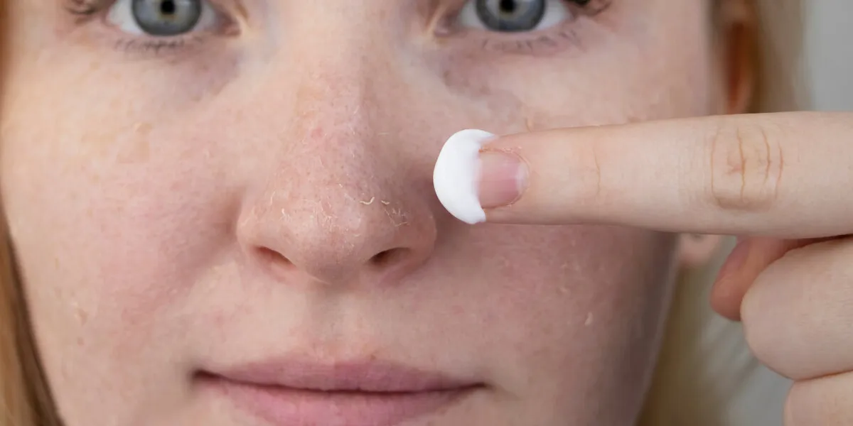 a woman examines dry skin on her face peeling, coarsening, discomfort, skin sensitivity patient at the appointment of a dermatologist or cosmetologist, selection of cream for dryness