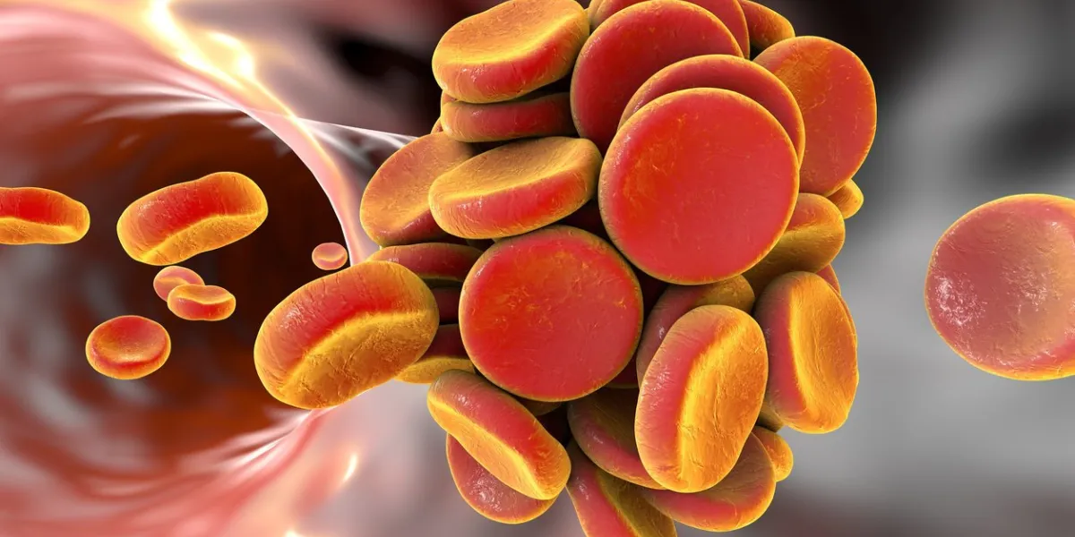 thromboembol in blood vessel clot formation, 3d illustration