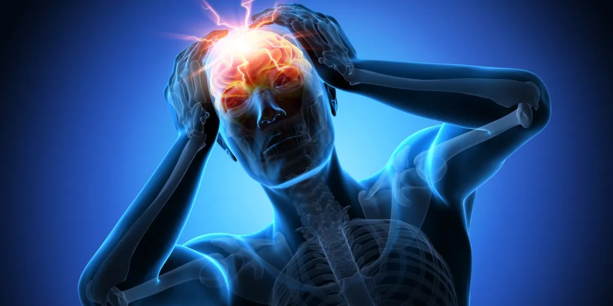 starke kopfschmerzen - migräne - medizinische illustration - 3d rendering