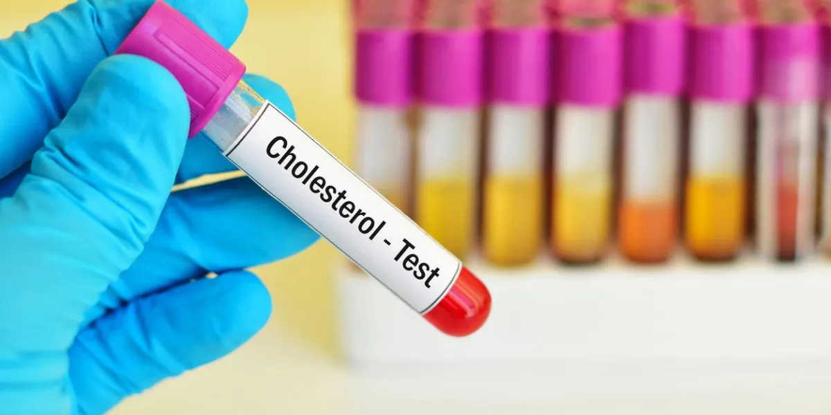 échantillon de sang pour le test de cholestérol